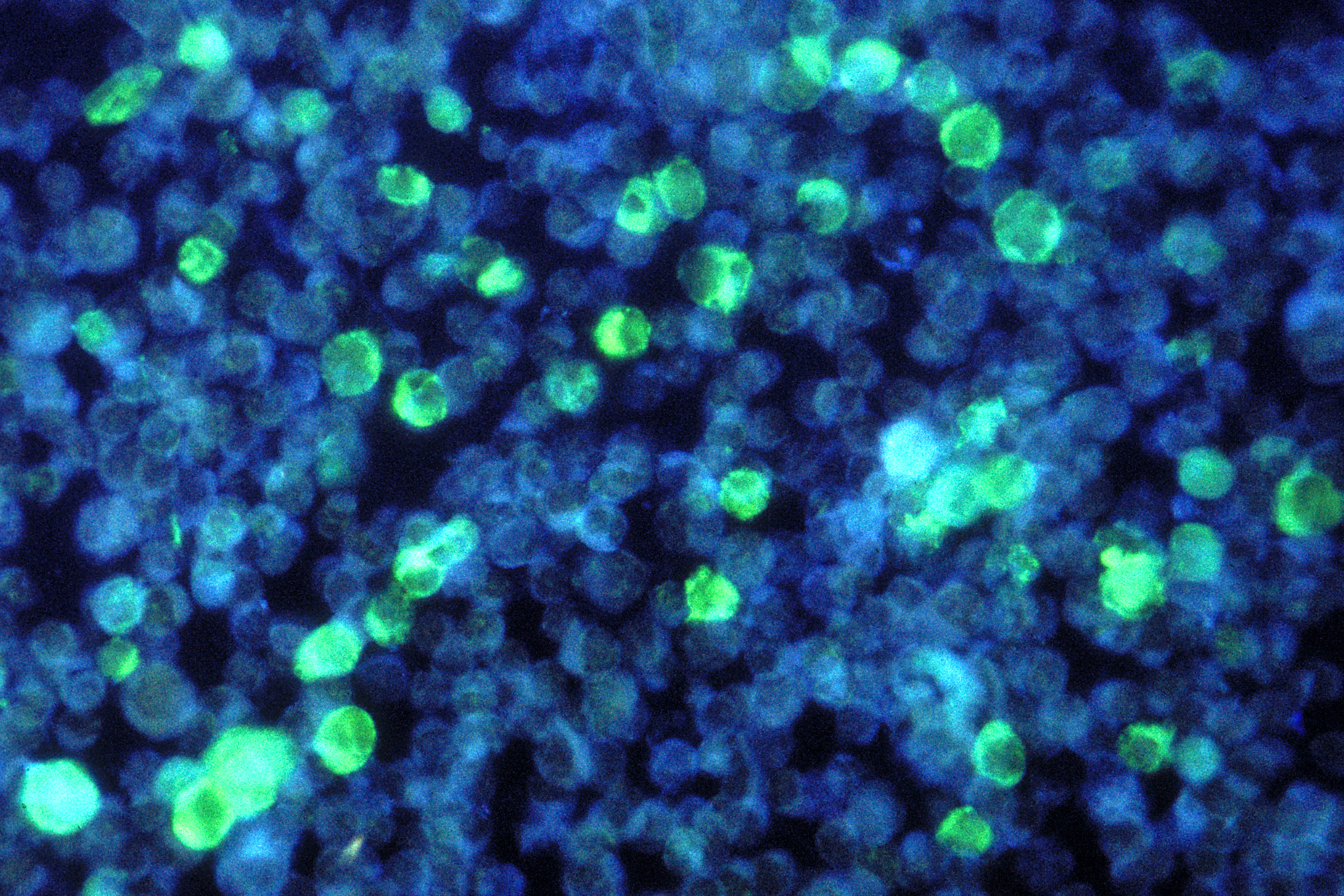 Cell Culture Media